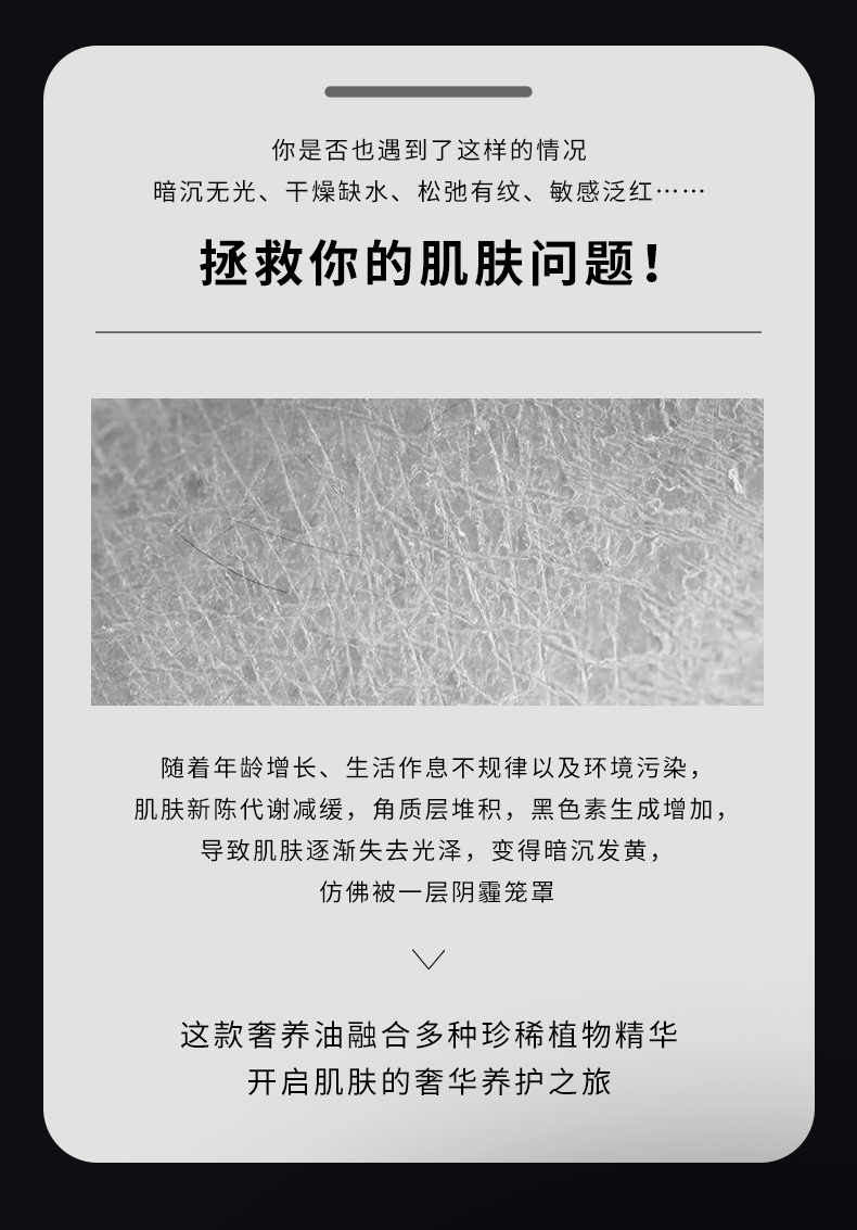 【限时秒杀】OUSIBEIYU欧思贝语永久花奢养肤油(立减100元)