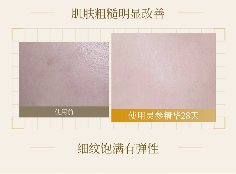 【诗美皇冠】焕颜灵参系列 精华露120ml|精华乳100ml|精华霜70g|精华液30ml|四件套装